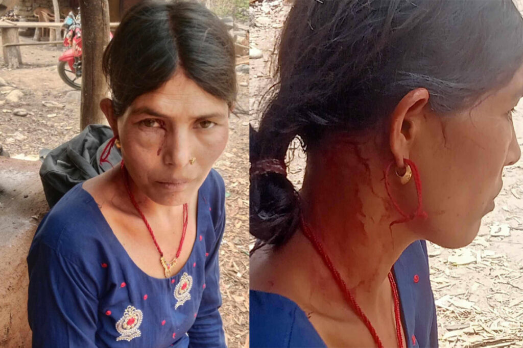 बैतडीमा चितुवाको आक्रमणबाट एक महिला घाइते
